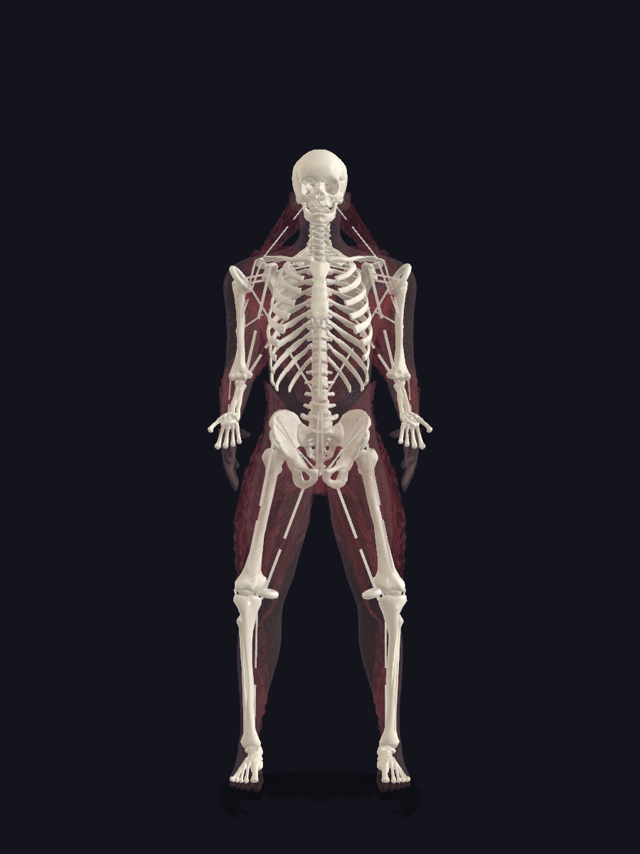 T1 — skeleton front view with bright white ring artifacts at both shoulders