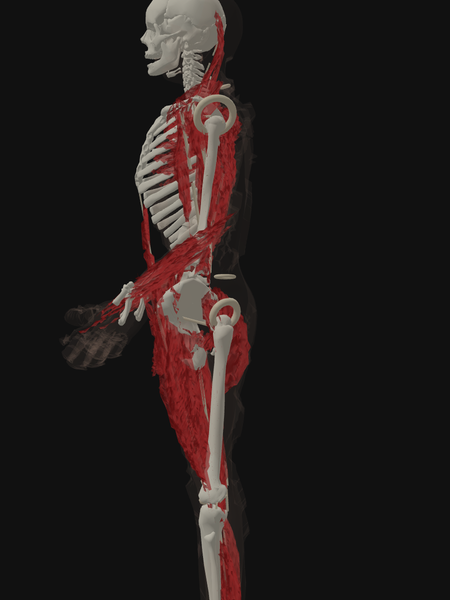 T3 — side view showing skin failing to cover hands and head